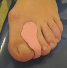 Separador de dedos a medida